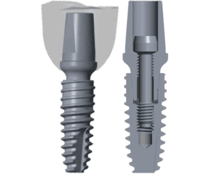 Dental Implants Manufacturer in India