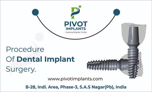 Procedure of Dental Implant Surgery