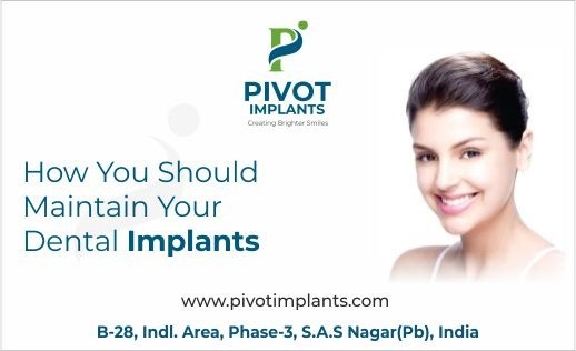 How You Should Maintain Your Dental Implants