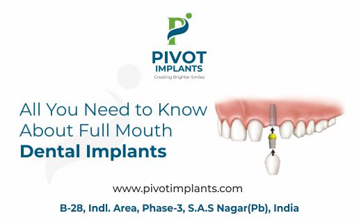 All You Need to Know About Full Mouth Dental Implants