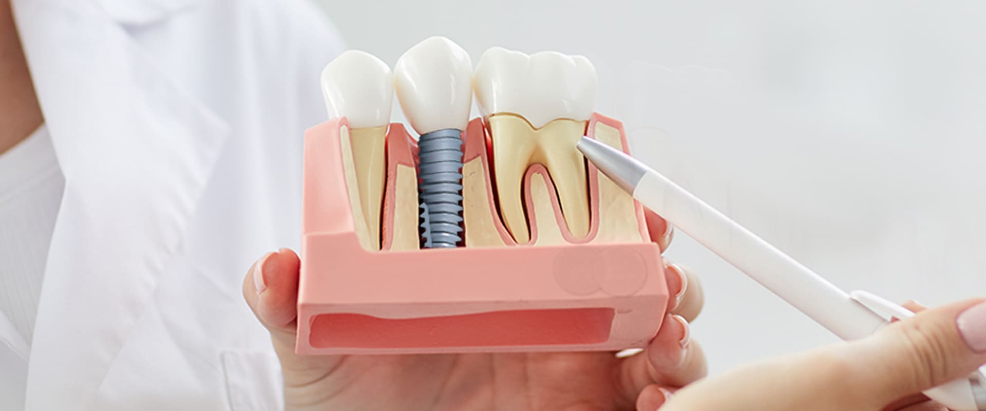 dental implants manufacturer in india