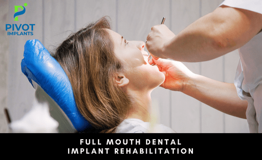 full mouth dental implant rehabilitation