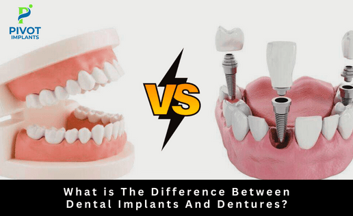 What is The Difference Between Dental Implants And Dentures?